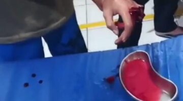 Seoarang Pemuda di Bacok Oleh Gangster dinihari, 3 Jari Tangan Putus